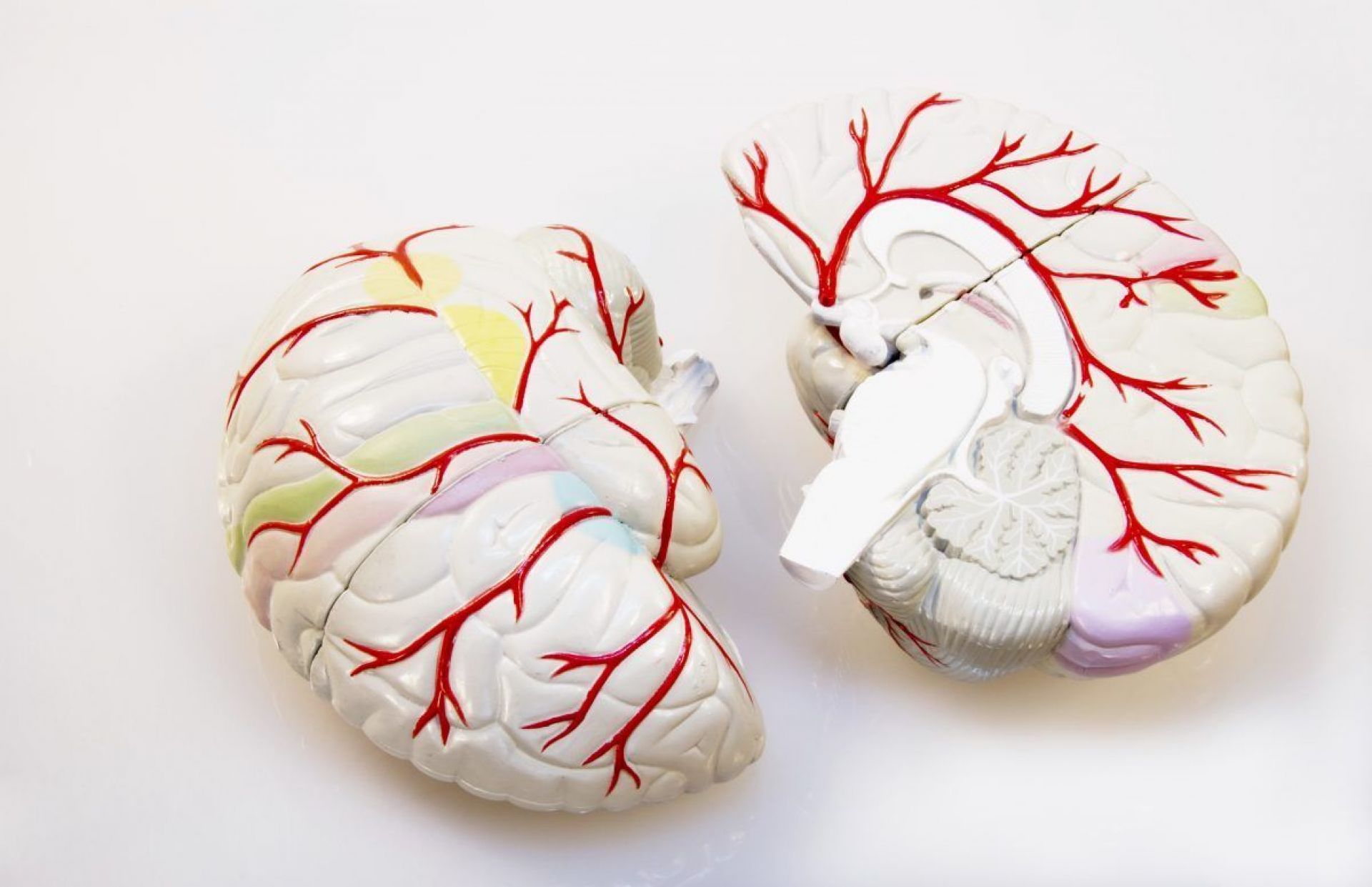 Cerebral infarction